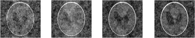 A new conjugate gradient algorithm for noise reduction in signal processing and image restoration